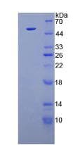 Human FGF1 / Acidic FGF Protein (Recombinant His-GST, N-terminus)