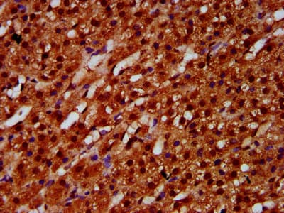 ETV5 / ERM Antibody