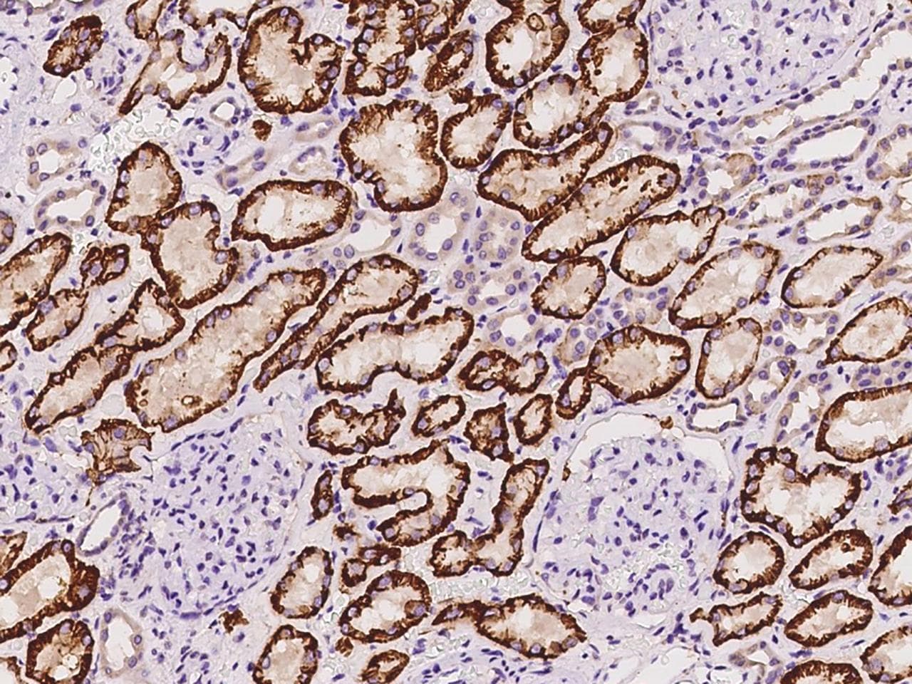 Polyclonal Rabbit anti-Human SLC4A4 / NBC1 Antibody (IHC)