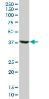 RNF2 / RING2 / RING1B Antibody (clone 2B6)