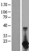 Human PPP1R14D / CPI17-Like Protein (Over-Expression Lysate Myc-DDK (Flag))