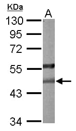 Polyclonal Rabbit anti-Human PON2 Antibody (aa1-295, IHC, WB)