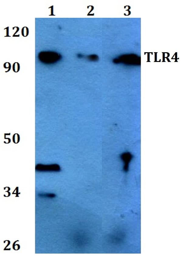 IHC-plus™ TLR4 Antibody (aa421-470)