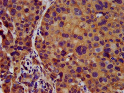 KCNJ8 / Kir6.1 Antibody