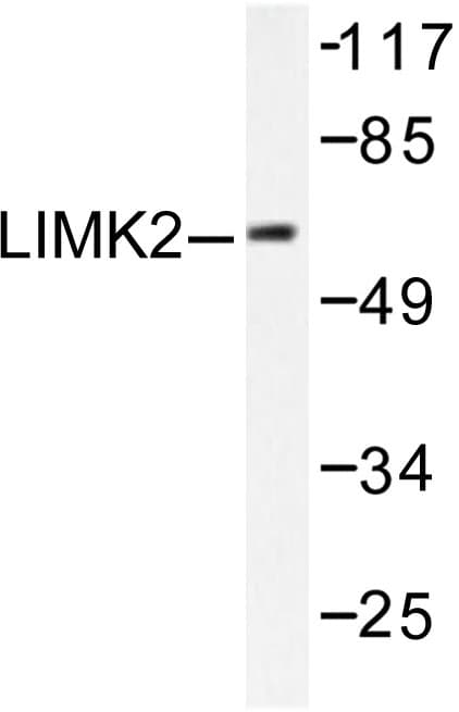 Polyclonal Rabbit anti-Human LIMK2 Antibody (Asp499, WB)
