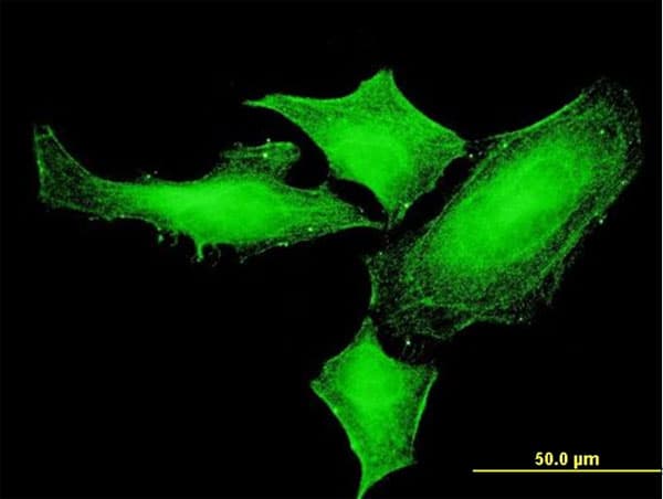IHC-plus™ PIM1 / Pim-1 Antibody (clone 6A2)