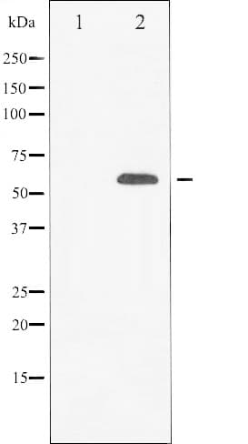 CBFA1 / RUNX2 Antibody