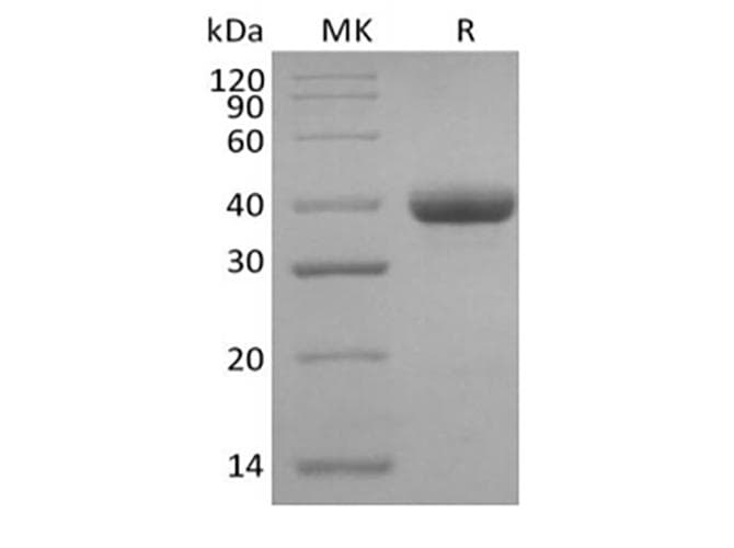 Human IgG3 Protein (Recombinant)