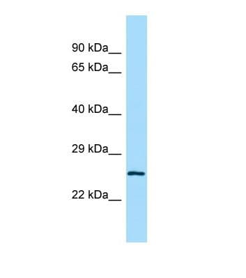 LRRC14 Antibody (aa422-471)