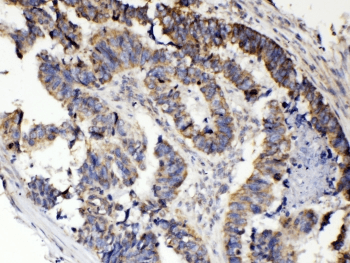 TNFRSF11A / RANK Antibody