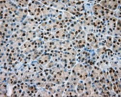 NIT1 Antibody (clone OTI3A11)