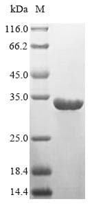 Human HLA-DRA Protein (Recombinant 6His, N-terminus)