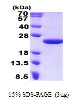 Human MCTS1 Protein (Recombinant His)