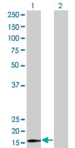 RPS15 / Ribosomal Protein S15 Antibody (clone 4H8)