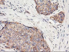 HARS2 Antibody (clone OTI6F9, Carrier-free)