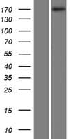 MAST1 Protein (Over-Expression Lysate Myc-DDK (Flag))