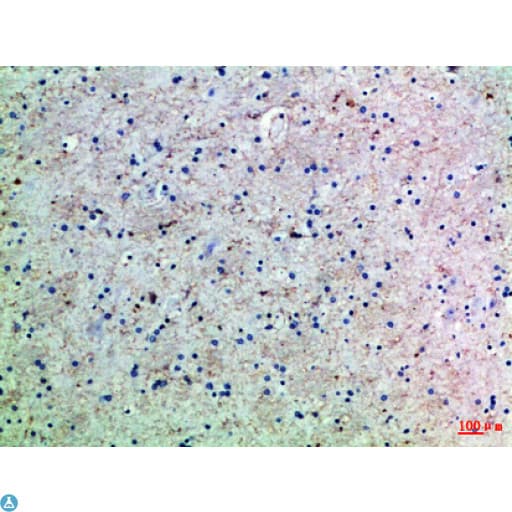 Polyclonal Rabbit anti-Human Leptin Antibody (WB)