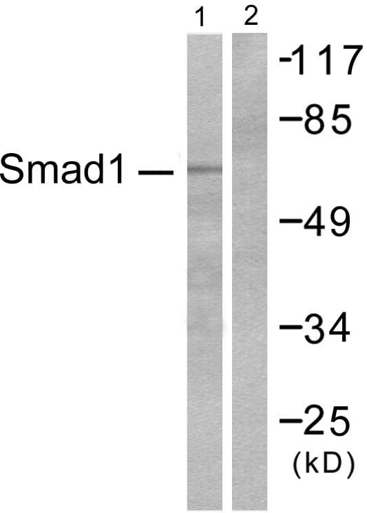 SMAD1 Antibody (p465)