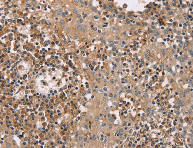 Polyclonal Rabbit anti-Human FAIM2 / LIFEGUARD Antibody (IHC)