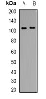 Polyclonal Rabbit anti-Human ANPEP / CD13 Antibody (C-Terminus, IHC, WB)