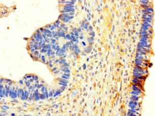 Polyclonal Rabbit anti-Human NSD3 / WHSC1L1 Antibody