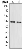 MPHOSPH10 / MPP10 Antibody (Internal)
