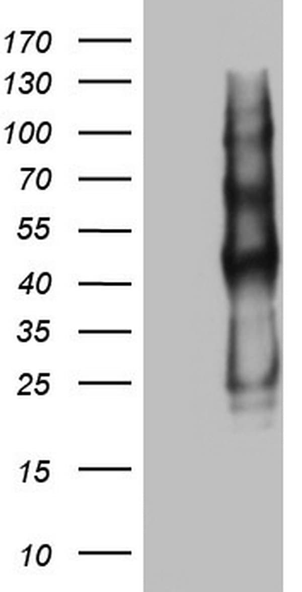 PROCR / EPCR Antibody (aa1-210, clone OTI12C4)