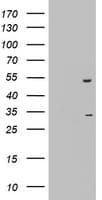 Monoclonal Mouse anti-Human OXSM / KS Antibody (clone OTI4E10, aa78-343, IHC, WB)
