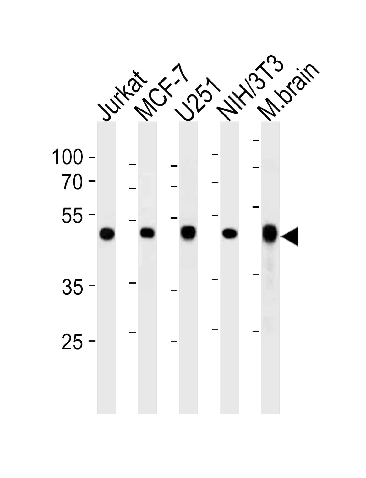 IHC-plus™ Polyclonal Rabbit anti-Human ENO1 / Alpha Enolase Antibody (aa178-205, IHC, IF, WB)