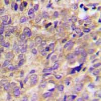 PTK2B / PYK2 Antibody (Internal)