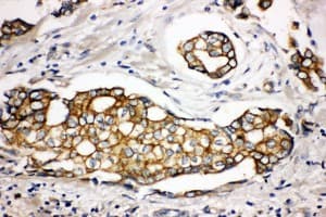 Polyclonal Rabbit anti-Human SPTLC1 / HSN1 Antibody (aa138-154, IHC, WB)