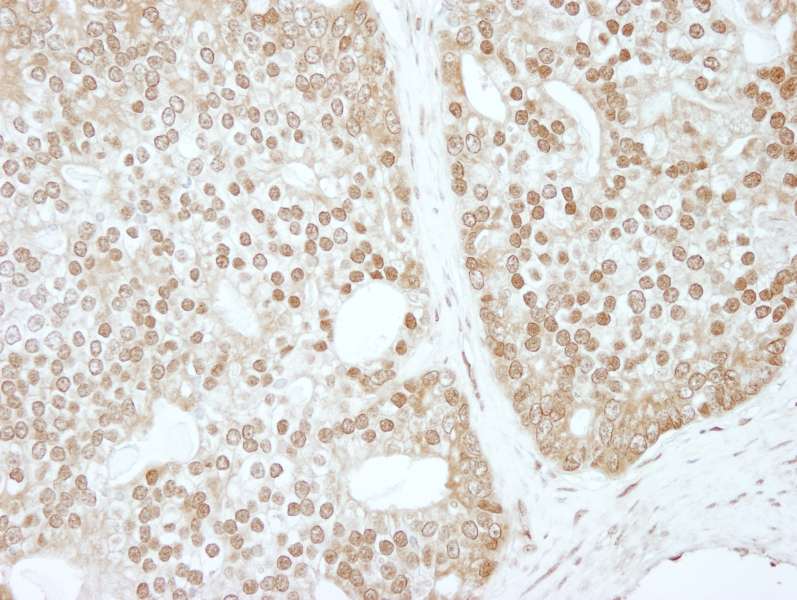 Polyclonal Rabbit anti-Human ZBTB40 Antibody (aa1140-1190, IHC, WB)