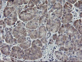 APP / Beta Amyloid Precursor Antibody (clone OTI4C9)
