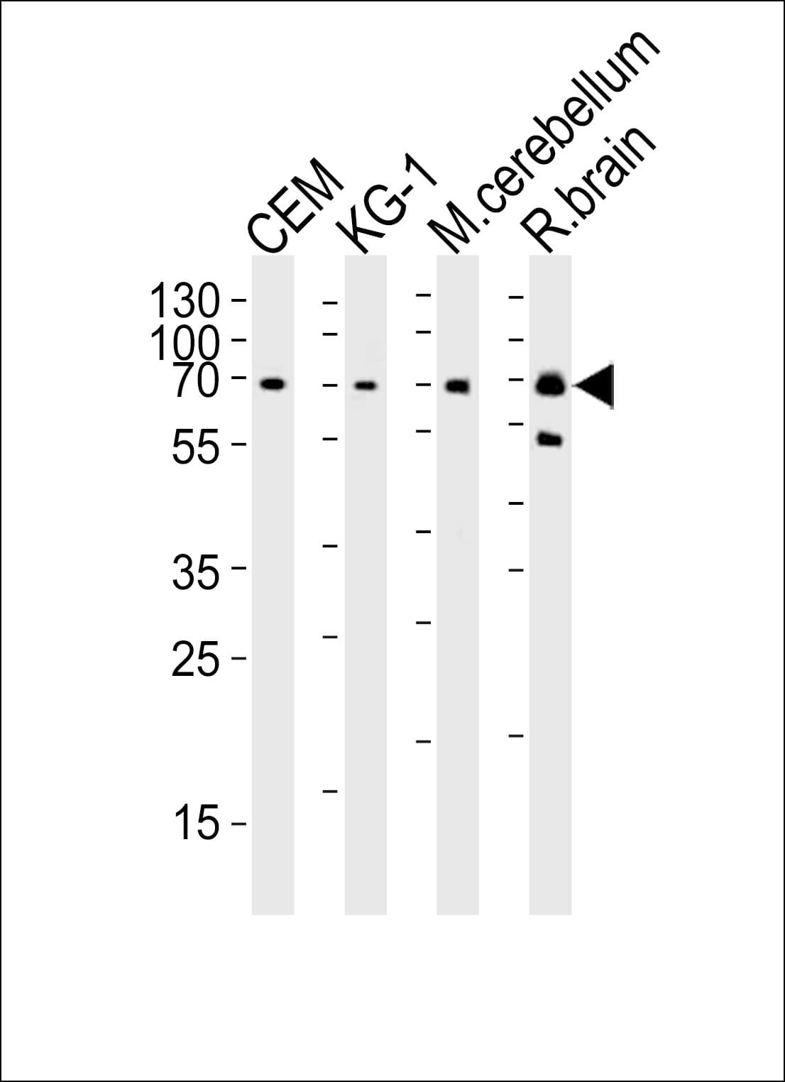 MTF2 / PCL2 Antibody (aa289-317)