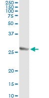 Monoclonal Mouse anti-Human TWIST1 / TWIST Antibody (clone 3E11, WB)