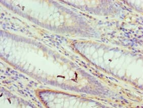 DFFA / ICAD / DFF45 Antibody (aa1-331)