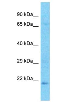 CRYBA2 Antibody (aa53-102)
