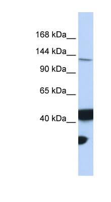MLH3 Antibody (aa1188-1237)