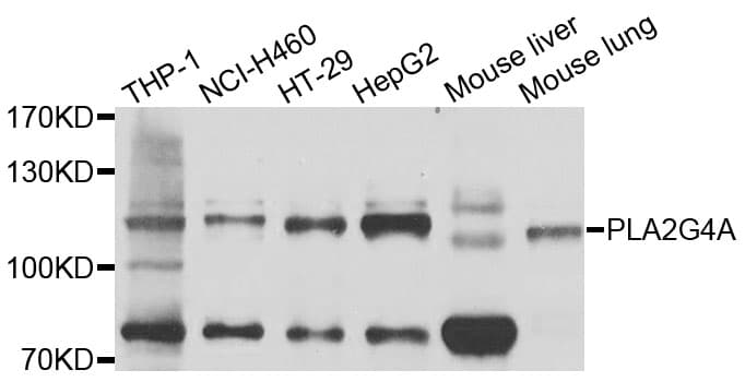 Polyclonal Rabbit anti-Human cPLA2 Antibody (WB)