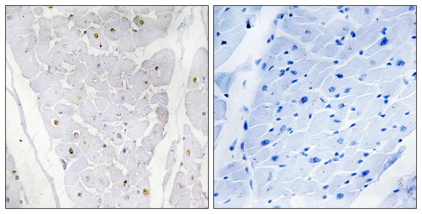 HAK / ALPK2 Antibody
