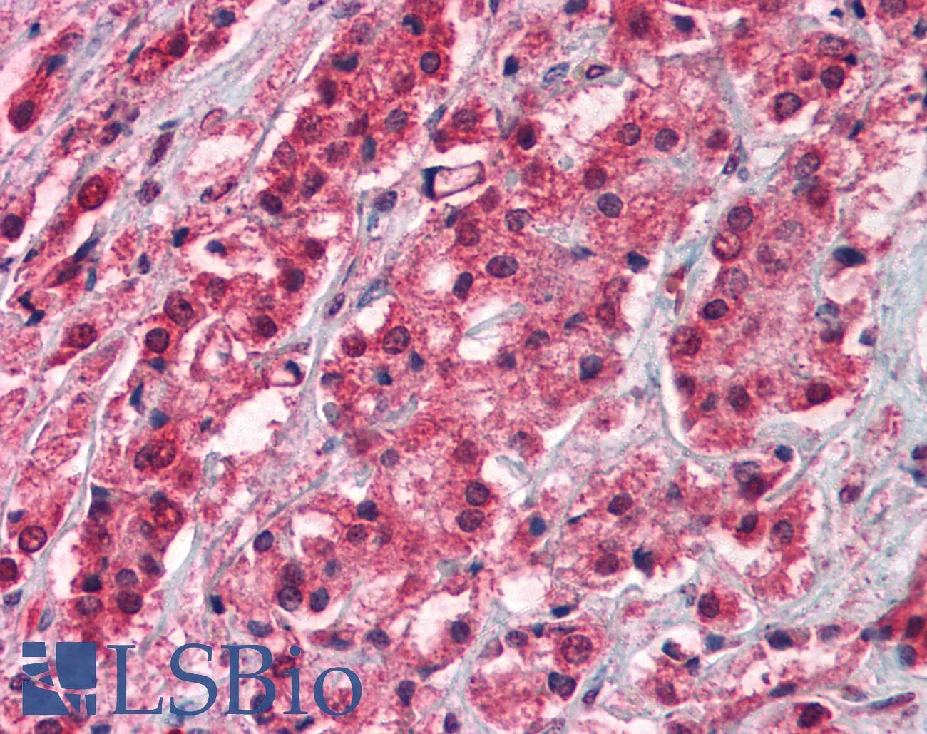 PathPlus™ Polyclonal Rabbit anti-Human TRPM8 Antibody (aa278-292, IHC)
