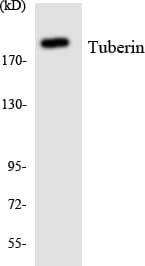 Tuberin / TSC2 Antibody (aa929-978)