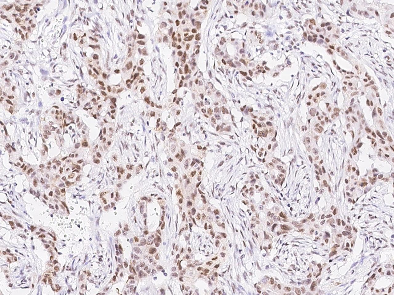 TCF12 / HEB Antibody