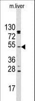 AKT2 Antibody (aa93-123)