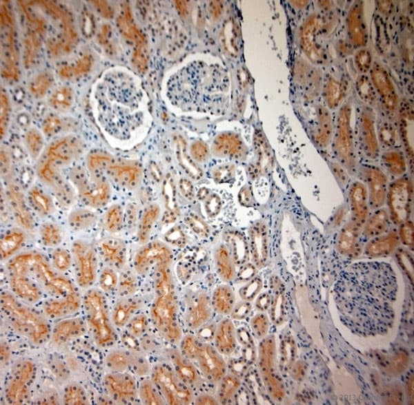 Polyclonal Rabbit anti-Human SLC17A3 Antibody (aa2-50, IHC)