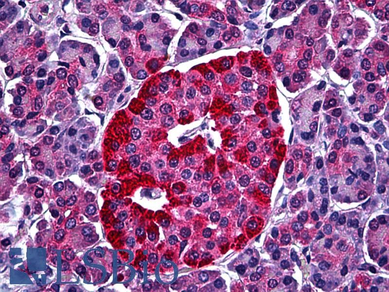 IHC-plus™ Monoclonal Mouse anti-Human STXBP1 / MUNC18-1 Antibody (clone 6D1, IHC, WB)