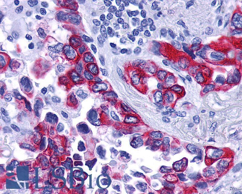 PathPlus™ Polyclonal Rabbit anti-Human GPBAR1 / TGR5 Antibody (C-Terminus, IHC)