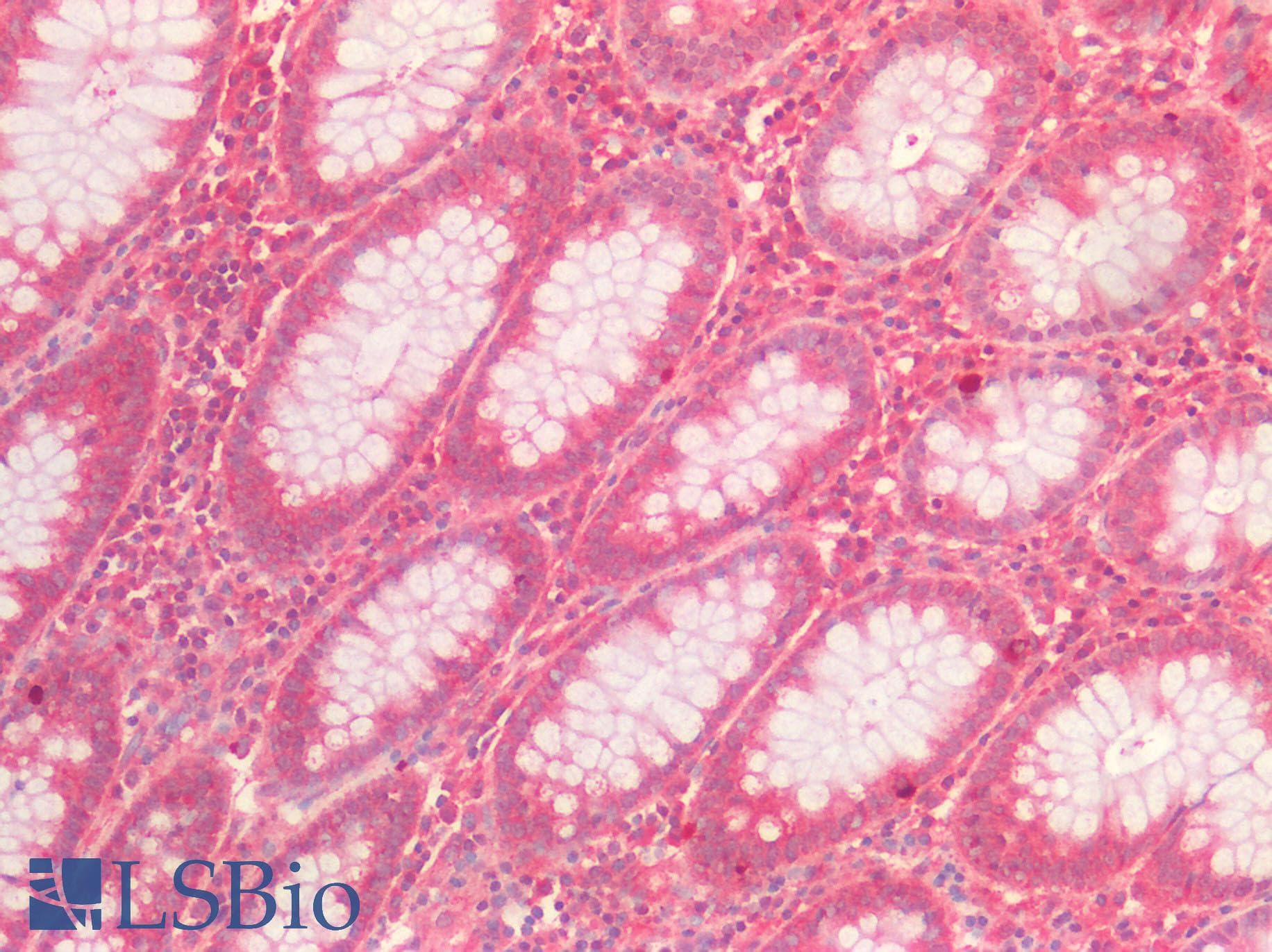 SEMA3C / Semaphorin 3C Antibody (aa292-396)