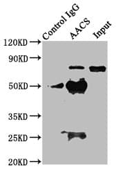 Polyclonal Rabbit anti-Human AACS Antibody (IHC, WB)