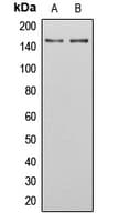 PRAGMIN / SGK223 Antibody (phospho-Tyr413)